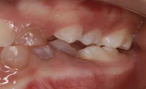 La cara de una persona
El contenido generado por IA puede ser incorrecto.