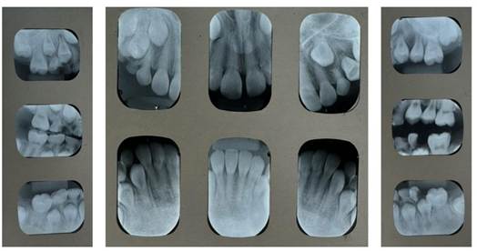 Imagen que contiene llenado, cubierto, diferente, grupo
El contenido generado por IA puede ser incorrecto.