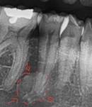 Imagen que contiene interior, cama, cobija, cuarto

El contenido generado por IA puede ser incorrecto.